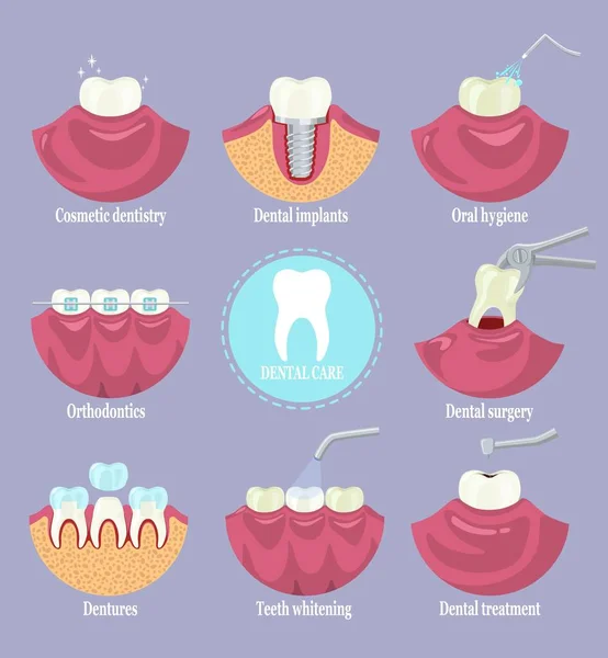 Conjunto de cuidado dental, ilustración aislada vector plano. Tipos de servicios de clínica odontológica. Odontología. — Archivo Imágenes Vectoriales