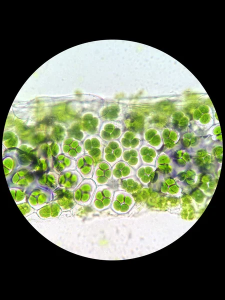 Растительные клетки с хлоропластом под микроскопом — стоковое фото