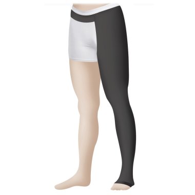 Varis için tıbbi kompresyon çorapları