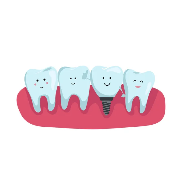 Dentition Sur Gencive Dents Avec Dessin Animé Implant Dentaire Design — Image vectorielle