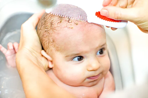 Eltávolítása fürödni baba bölcső sapka fésű — Stock Fotó