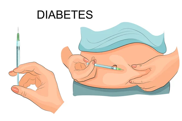 Iniezione di insulina in una pancia. Illustrazione vettoriale . — Vettoriale Stock