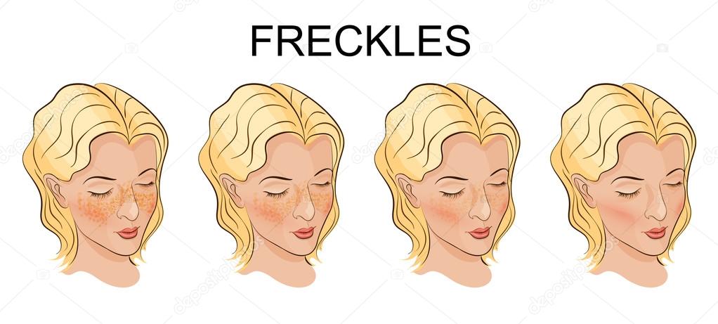 a face with freckles young women