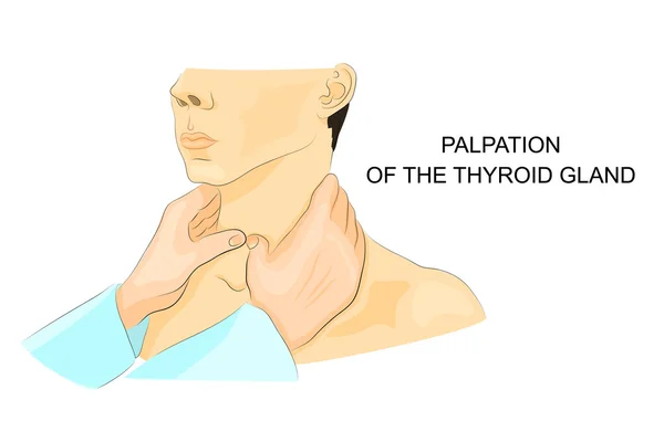 PALPATION OF THE THYROID GLAND — Stock Vector