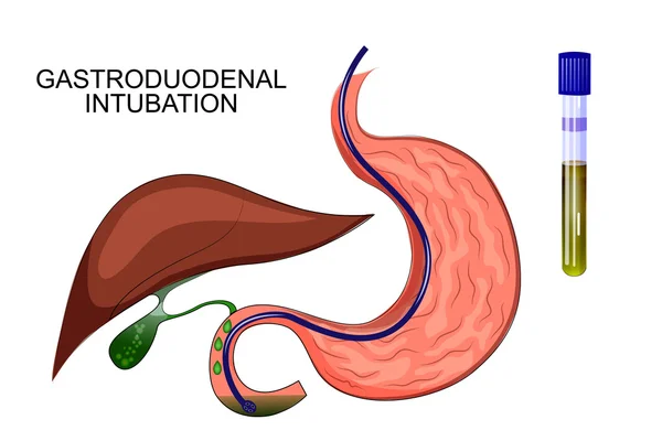 十二指肠探空胃，胃肝 — 图库矢量图片