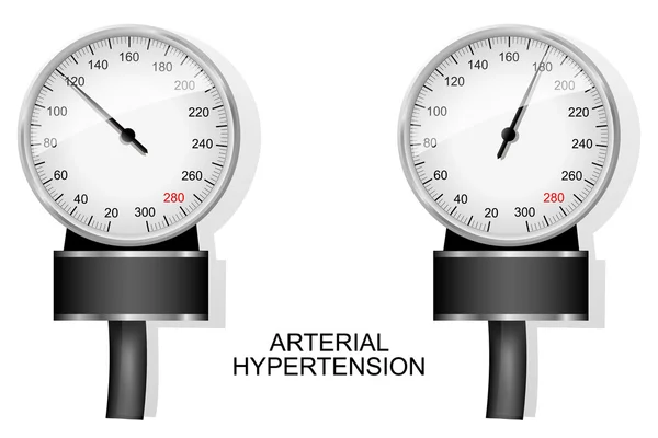 Tonómetro para medir la presión arterial — Vector de stock