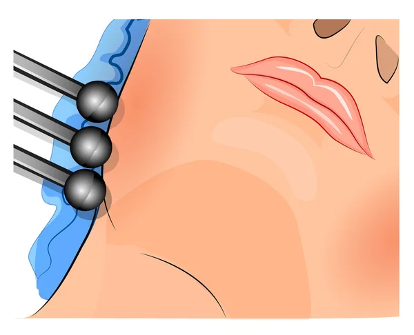 Rosto feminino e aparelhos para massagem vibratória — Vetor de Stock