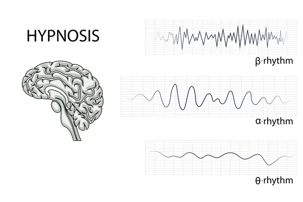 Las ondas eléctricas cerebrales — Archivo Imágenes Vectoriales