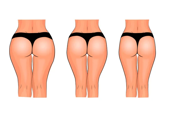 Nalgas de las mujeres. pérdida de peso. Aptitud. comparación — Vector de stock