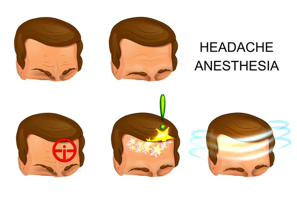 Male head, pain, analgesia — Stock Vector