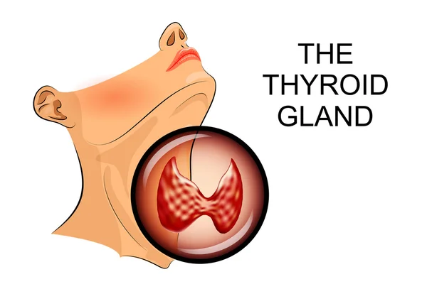 Ultrasound diagnostics of thyroid — Stock Vector