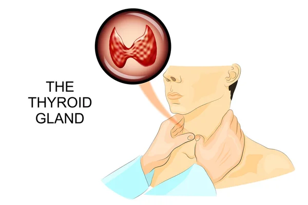 PALPAZIONE DELLA ghiandola tiroidea — Vettoriale Stock