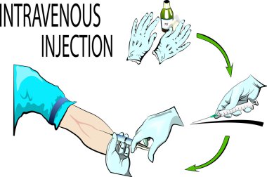 intravenöz enjeksiyon