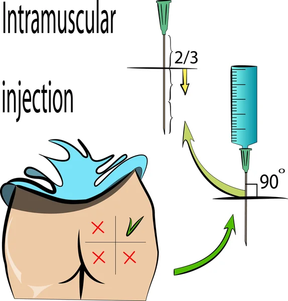 Inyección intramuscular — Vector de stock