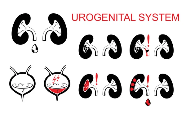 Urogenitális rendszer, a vesék, húgyhólyag. — Stock Vector