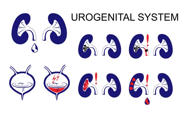 Urogenital system, kidneys, bladder. — Stock Illustration Urogenital system, kidneys, bladder. Stock Illustration