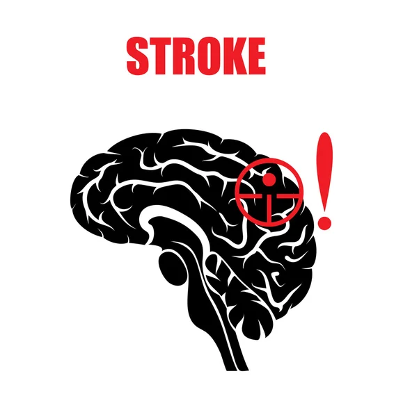 Stroke — Stock Vector
