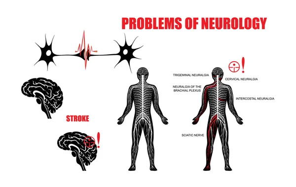 PROBLEMS OF NEUROLOGY — Stock Vector