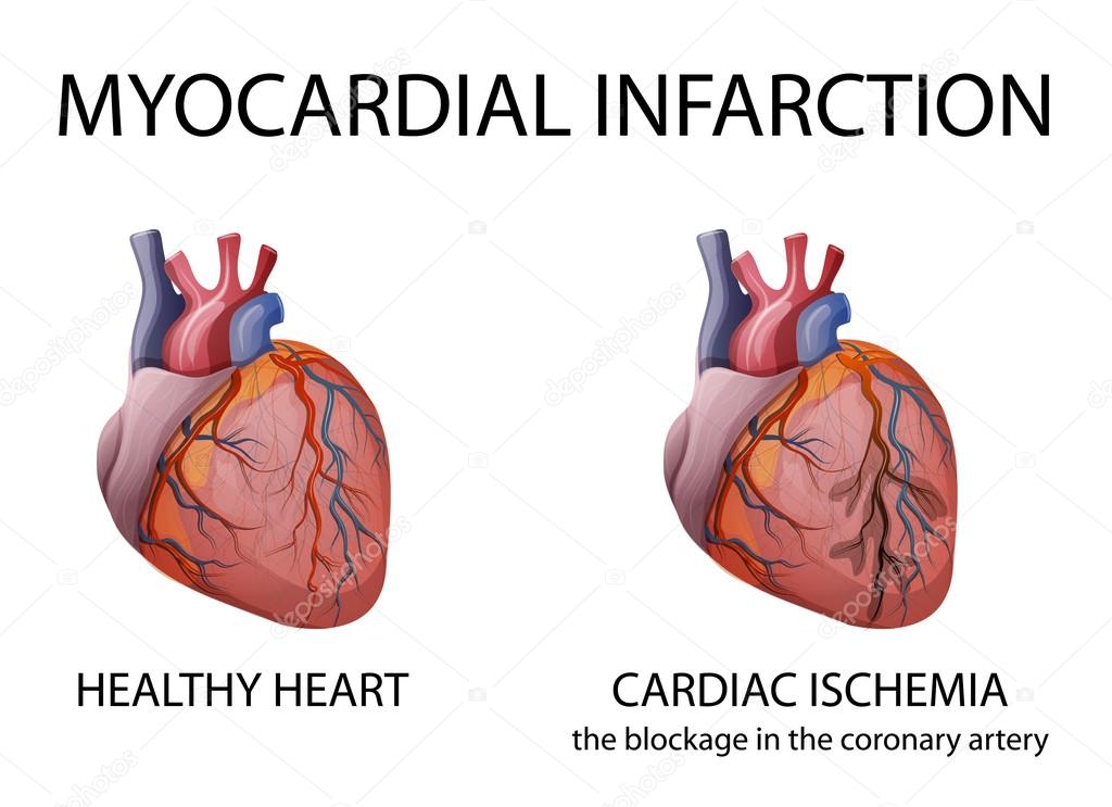 healthy human heart diagram