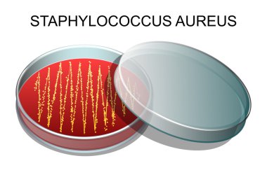 Staphylococcus aureus.v vektör