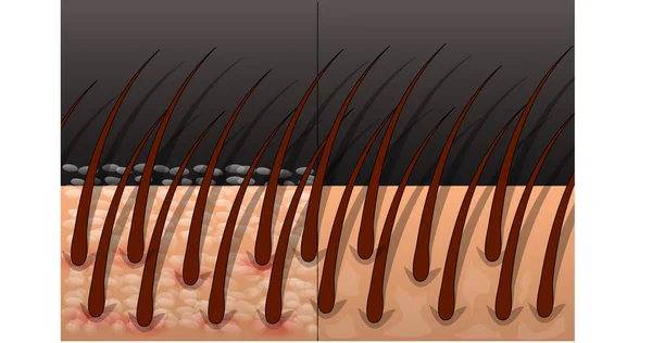 Cabelo e pêlo —  Vetores de Stock