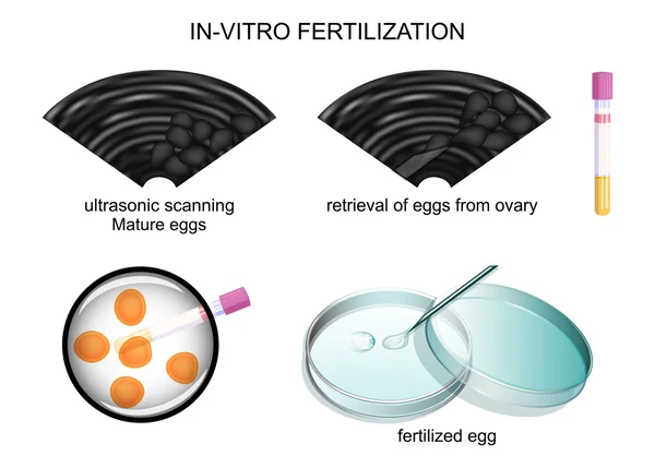 Оплодотворение in vitro — стоковый вектор