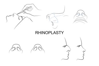 plastic nose. cosmetic surgery. clipart