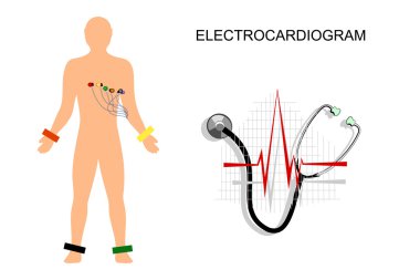 EKG, göğüs üzerinde elektrotlar hastayla.