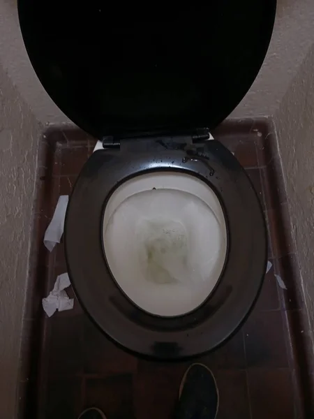 Watery Diarrhea In Toilet watery-diarrhea-in-toilet