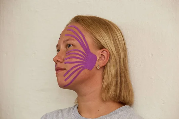 Girls face in profile with kinesiological tapes for cheeks