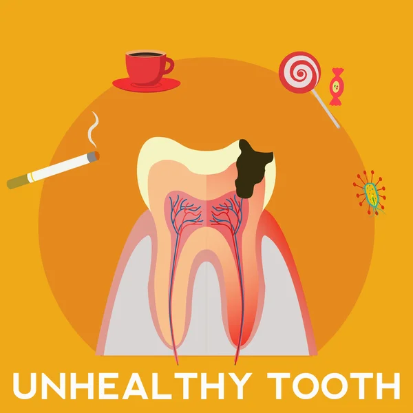 Ungesunde Zähne und Vektor-Konzept für schlechte Gewohnheiten — Stockvektor