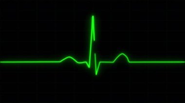 Konsept 2-E1 Gerçekçi kalp atışı monitörü elektrokardiyogram ekranında animasyon.