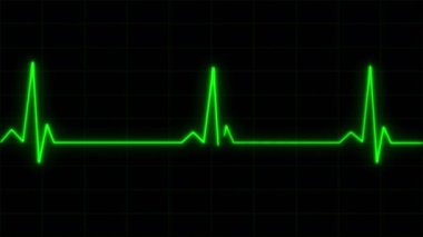 Konsept 8-E1 Gerçekçi kalp atışı monitörü elektrokardiyogram ekranında animasyon.