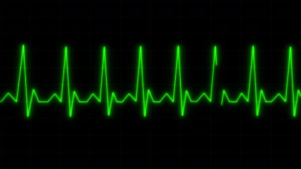 Concept Realistische Hartslagmeter Animatie Elektrocardiogram Scherm — Stockvideo