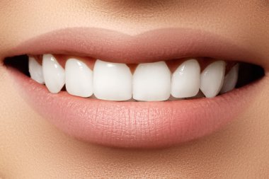 Büyük sağlıklı beyaz dişleri ile genç taze kadın güzel geniş gülümseme. Beyaz üzerinde vali beyaz dişleri ile gülümseyen kadın closeup 