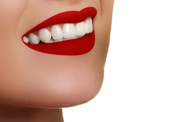 Sonrisa perfecta después del blanqueamiento. Cuidado dental y blanqueamiento de dientes. Estomatología y cuidado de belleza. Mujer sonriendo con grandes dientes. Sonrisa femenina alegre con piel fresca y clara — Foto de Stock