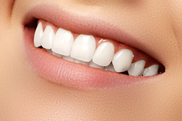 Belo sorriso com dentes clareadores. Fotografia dentária. Macro closeup de boca feminina perfeita, lipscare — Fotografia de Stock