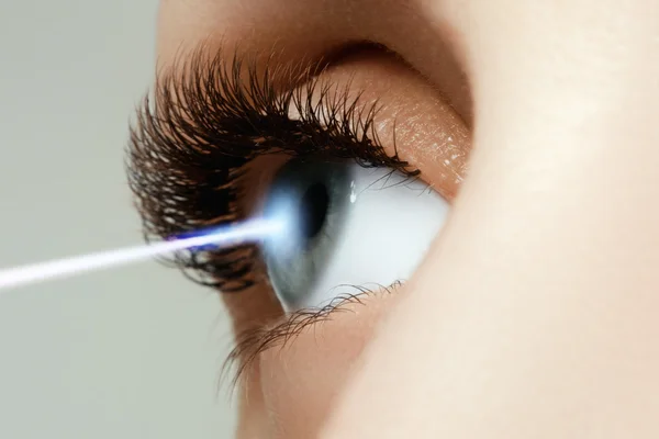 Laser vision correction. Woman's eye. Human eye. Woman eye with laser correction. Eyesight concept. Future technology, medicine and vision concept — Stock Photo, Image