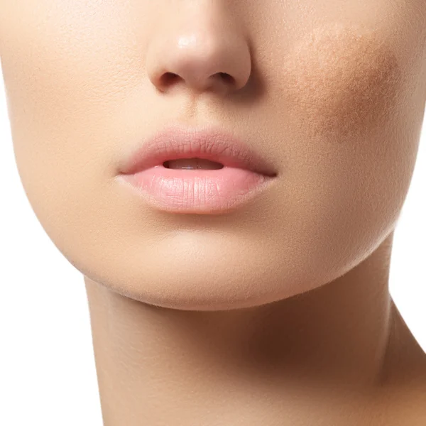 Part of the woman's face with damaged skin. Make-up & cosmetics — Stock Photo, Image