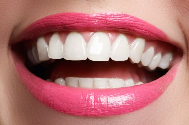Perfect smile after bleaching. Dental care and whitening teeth. Woman smile with great teeth. Close-up of smile with white healthy teeth