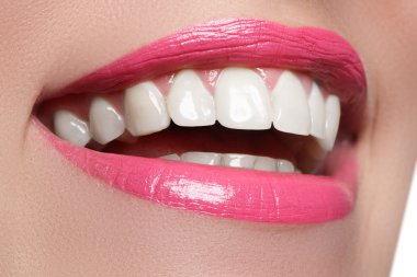 Perfect smile after bleaching. Dental care and whitening teeth. Woman smile with great teeth. Close-up of smile with white healthy teeth