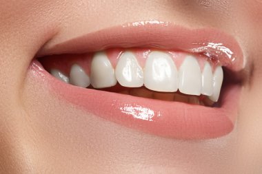 Perfect smile. Beautiful natural full lips and white teeth. Teeth whitening.