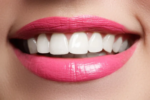 Sorriso perfeito após o branqueamento. Cuidados dentários e clareamento dos dentes. Mulher sorrir com grandes dentes. Close-up de sorriso com dentes brancos saudáveis — Fotografia de Stock