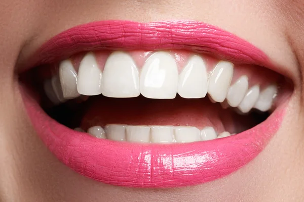 Sonrisa perfecta después del blanqueamiento. Cuidado dental y blanqueamiento de dientes. Mujer sonrisa con grandes dientes. Primer plano de la sonrisa con dientes blancos y sanos — Foto de Stock