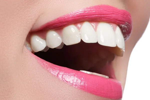 Sorriso perfetto dopo la decolorazione. Cura dentale e sbiancamento dei denti. Una donna sorride con grandi denti. Primo piano del sorriso con denti bianchi sani — Foto Stock