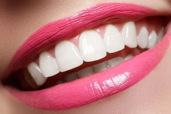 Sorriso perfeito após o branqueamento. Cuidados dentários e clareamento dos dentes. Mulher sorrir com grandes dentes. Close-up de sorriso com dentes brancos saudáveis — Fotografia de Stock