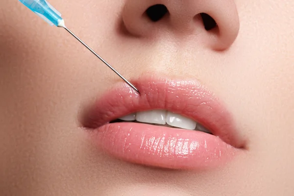 Closeup of beautiful woman gets injection in her lips. Full lips. Beautiful face and the syringe (plastic surgery and cosmetic injection concept). Botox injections.