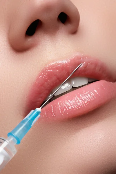 Closeup of beautiful woman gets injection in her lips. Full lips. Beautiful face and the syringe (plastic surgery and cosmetic injection concept). Botox injections.