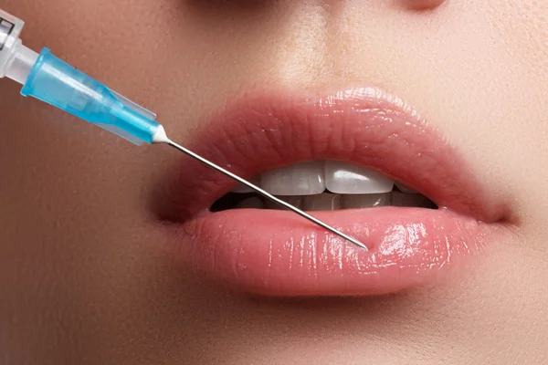 Closeup of beautiful woman gets injection in her lips. Full lips. Beautiful face and the syringe (plastic surgery and cosmetic injection concept). Botox injections. — Stock fotografie