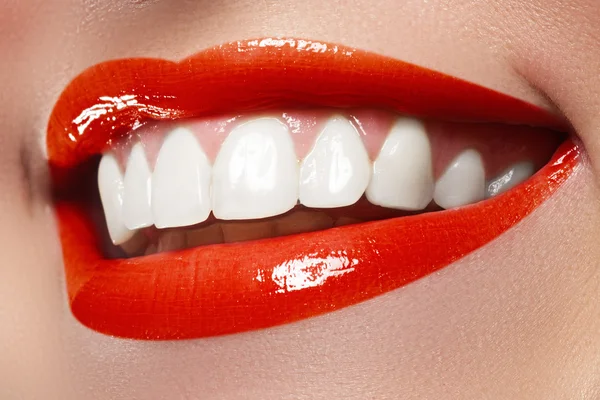 Perfect smile before and after bleaching. Dental care and whitening teeth — Stock Photo, Image